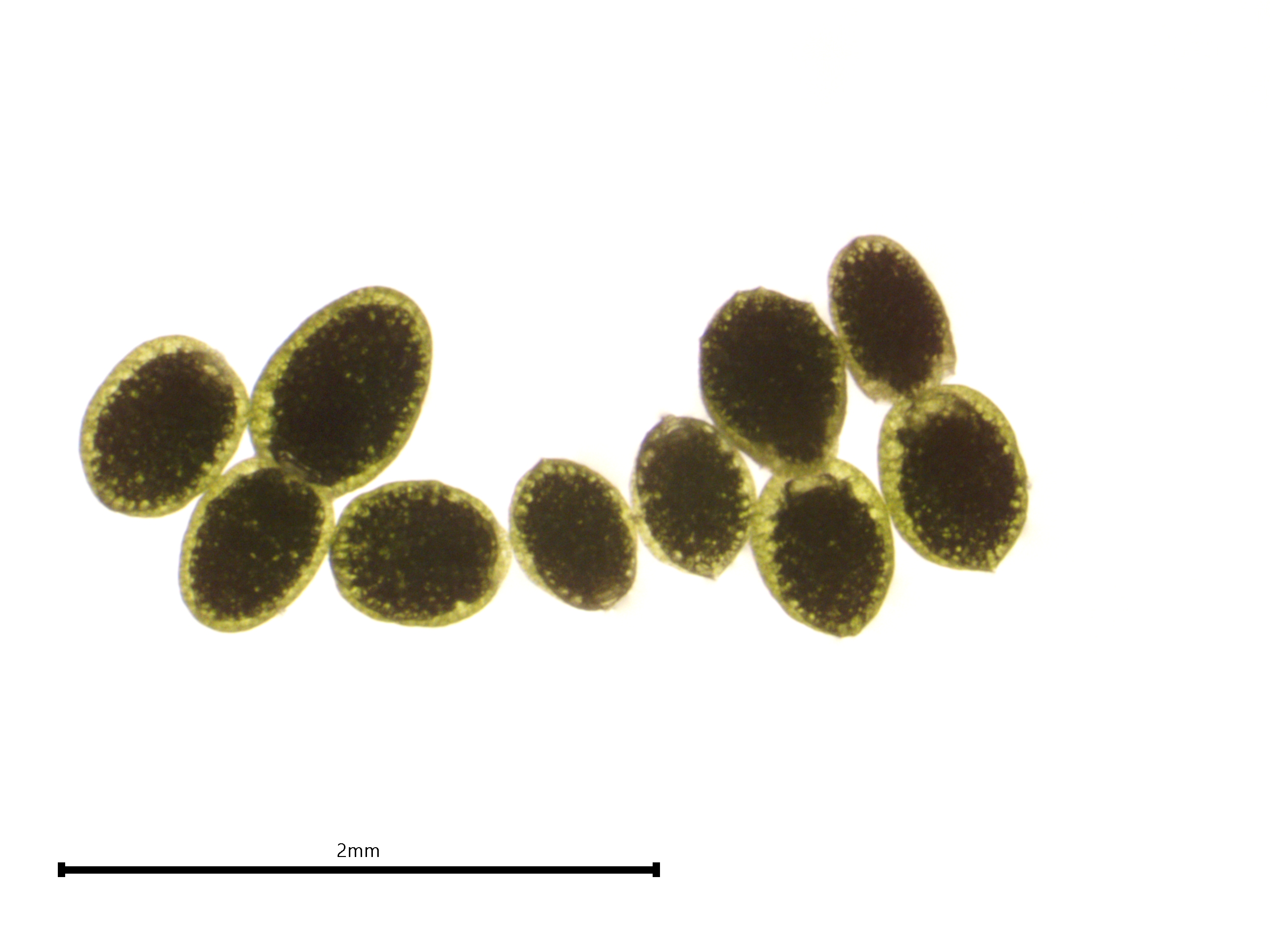 Wolffia globosa clone 9319